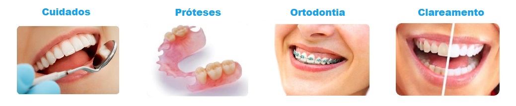 Coberturas Amil Dental E170 (Clássico + Próteses + Ortodontia + Clareamento) Coberturas Amil Dental E170 (Clássico + Próteses + Ortodontia + Clareamento)