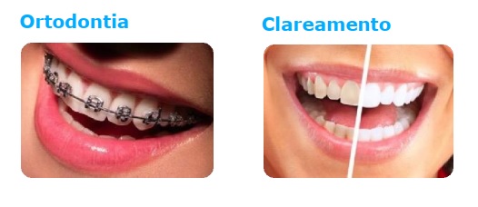 Coberturas Amil Dental E80 (ortodontia: aparelhos)