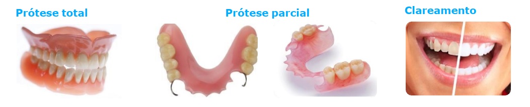 Coberturas Amil Dental E60 e E90 (próteses: reposição dentária)