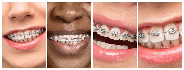 Plano Ortodontia, cuidando do sorriso