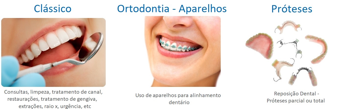 Tipos de Planos e Coberturas